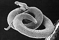 "Schistosoma_mansoni2.jpg" by User:File Upload Bot (Magnus Manske)